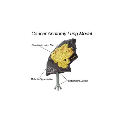 YILIANHUA Smoker Lung Model+Healthy Lung Model, A 1:1 Life India | Ubuy