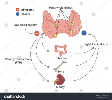 Symptoms Hyperparathyroidism Parathyroid Glands Hyperparathyroidism Symptoms Stock Illustration ...