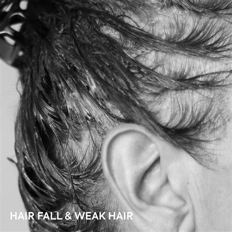 Hair Fall & Weak Hair – FreshLuxe