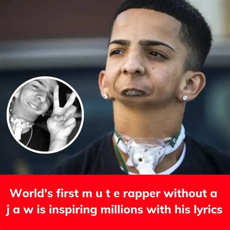 World's first m u t e rapper without a j a w is inspiring millions with ...