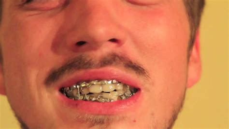 Zach Moon - Love Interruption (Jack White Cover) w/ Jaw Wired Shut ...