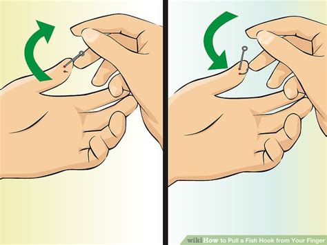 Image result for String Pull Method Fish Hook Removal