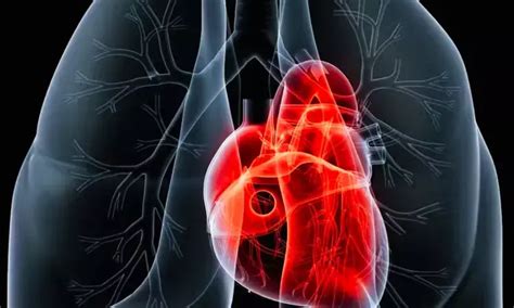 Intermediate- to long-term amiodarone use safe and may not increase ...