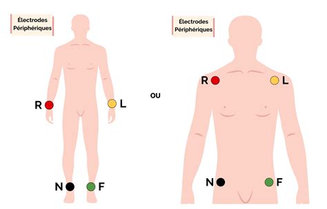 Guide : Comment poser des électrodes pour un ECG de repos