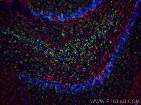MAP2 antibody (17490-1-AP) | Proteintech