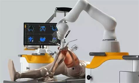 Robotic Innovations in Orthopedics