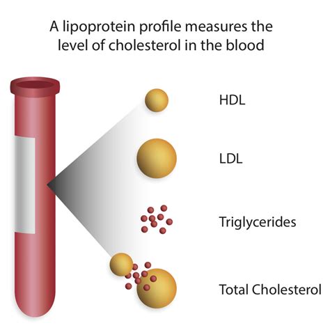 Lipid-panel - T H E 6 T H F L O O R