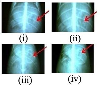Fig.4: X-ray radiograms showing presence of VFIG in gastric region of ...