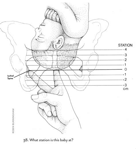 Station | Midwifery student, Midwifery, Obstetrics and gynaecology