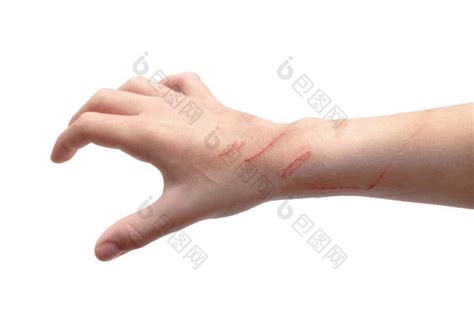 小孩的手在手腕上被猫抓伤了因白人背景而被图片-包图网企业站