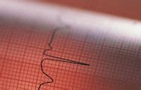 Vascular Concepts - State of the art Endovascular Devices