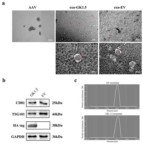 Exosome-Modified AAV Gene Therapy Attenuates Autoimmune Hepatitis via ...