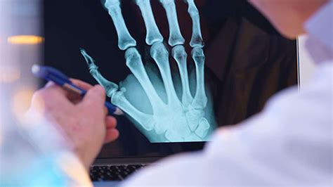 Department of Radiology - Shri Shankaracharya Institute Of Medical Sciences