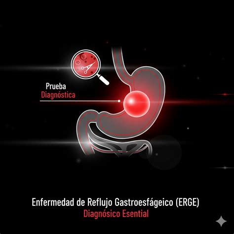 Enfermedad de Reflujo Gastroesofágico (ERGE): Guía completa para aumentar tu productividad. - La ...
