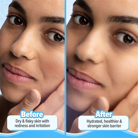 5 Barrier+ Repair Moisturizer with Avocado & 5 Essential Ceramides - 1 ...