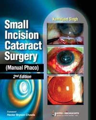Buy Small Incision Cataract Surgery (Manual Phaco) (POD) Book Online at ...