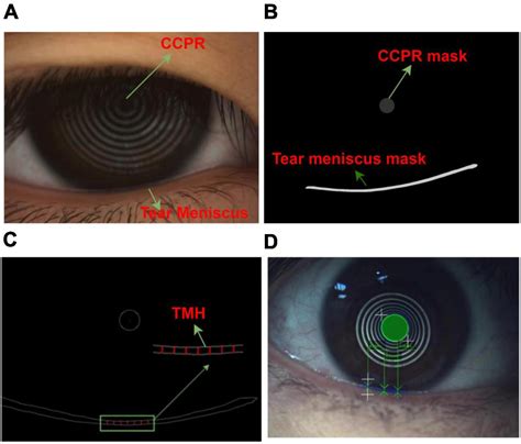 Frontiers | Measurement method of tear meniscus height based on deep learning