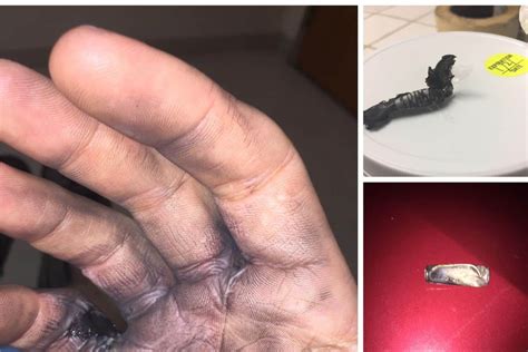 Image result for Vape Exploding News