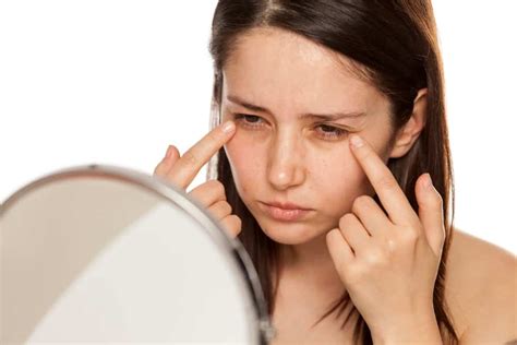 Under Eye Dark Circles and Puffiness - the causes and treatments ...