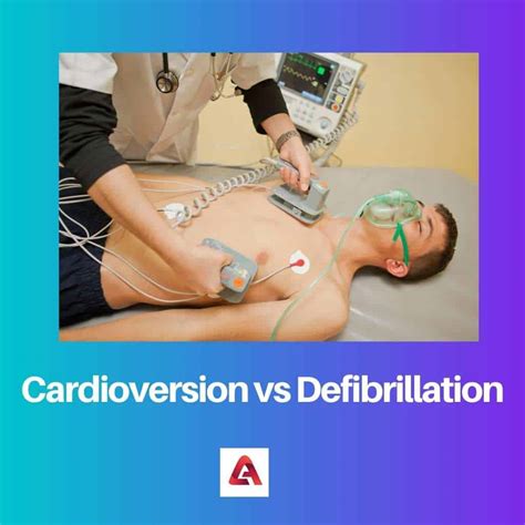 Cardioversion vs Defibrillation: Difference and Comparison