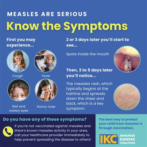 Measles | IKC