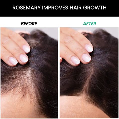 ThriveCo Rosemary Hair Kit with Shampoo, Conditioner & EO