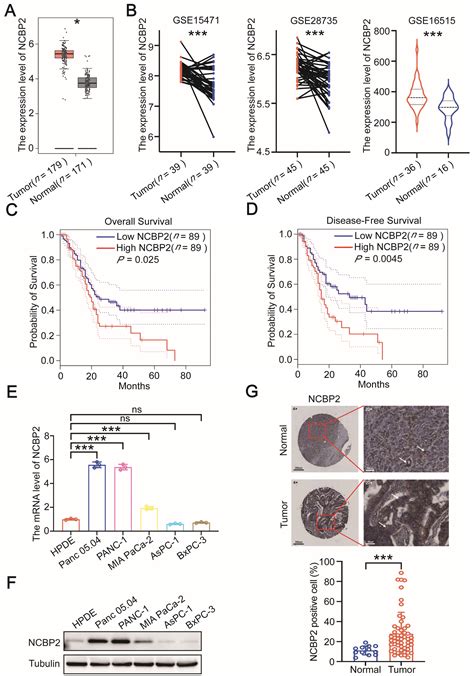 The m7G Reader NCBP2 Promotes Pancreatic Cancer Progression by ...