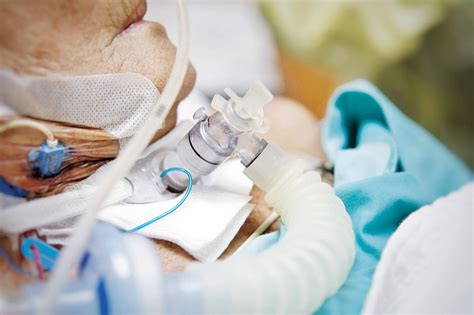 Patient Overbreathing The Vent at Kristopher Chambers blog