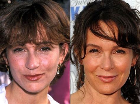 Bildergebnis für celebrities+that+have+plastic+surgery