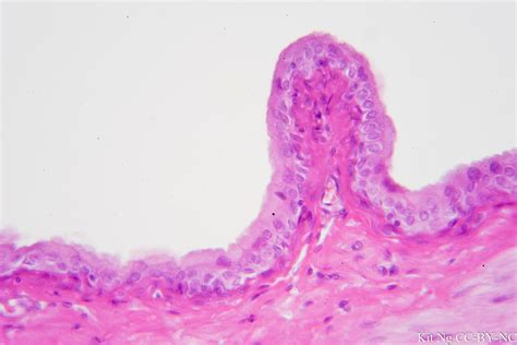 Image result for Transitional Epithelial Cells