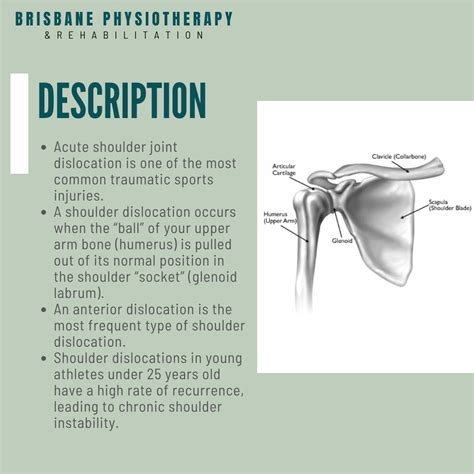 Anterior Shoulder Dislocation