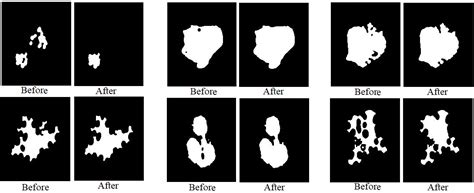 Multi-Method Diagnosis of Blood Microscopic Sample for Early Detection ...