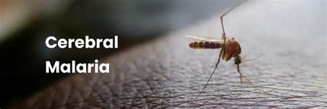 Cerebral Malaria: Causes, Symptoms & Care