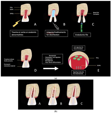Tissue Characteristics in Endodontic Regeneration: A Systematic Review