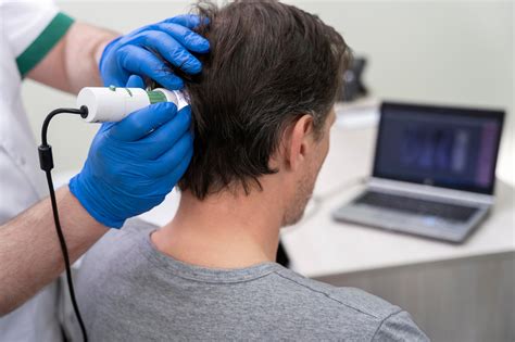 Malassezia Scalp Treatment: Managing Fungal Dandruff, Itching & Scalp ...