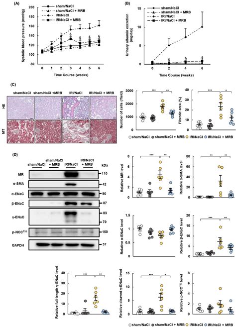 Upregulation of Mineralocorticoid Receptor Contributes to Development ...