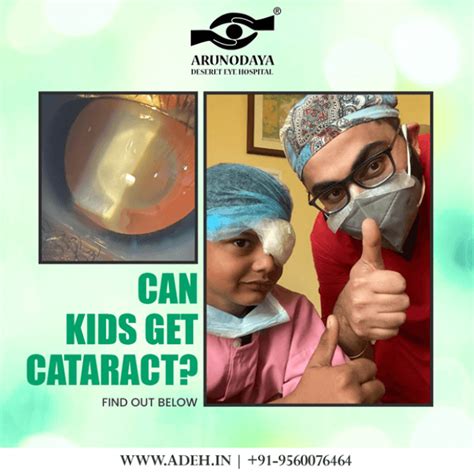 CAN KIDS GET CATARACT?