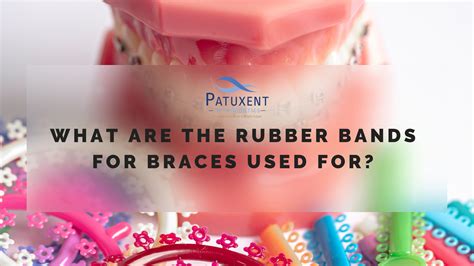 Where To Get Rubber Bands Discount | www.cumberland.org