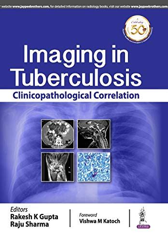 Buy Imaging in Tuberculosis: Clinicopathological Correlation Book ...