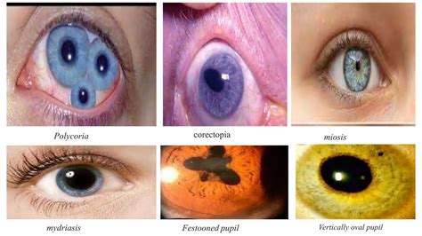 Image result for Iris Recognition Using MATLAB Source Code