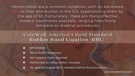 Save Yourself from Hemorrhoids with Rubber Band Ligation - ColoWell America | Proctology and ...
