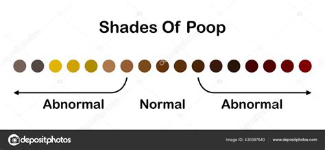 Image result for Healthy Poop Color