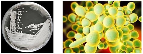 真菌染色液是我们常见的诊断真菌感染的试剂消灭真菌的方法原理都有哪些？-中仁医学