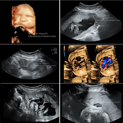 Advanced Fetal Medicine Services in Hyderabad | Dr. Navya KC