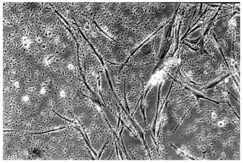 Cytotoxicity of Self-Etch Versus Etch-and-Rinse Dentin Adhesives: A ...