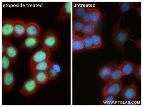 Phospho-P53 (Ser15) antibody (80195-1-PBS) | Proteintech