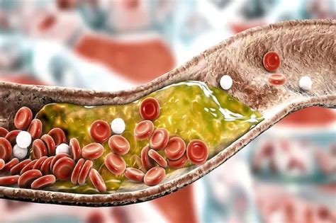 High Cholesterol Control Tips: পাঁচটি সুপার ডুপার ভিটামিন, ভিটামিন সি ...