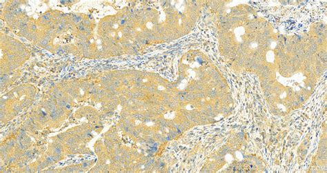 CYP2W1 antibody (67419-1-Ig) | Proteintech