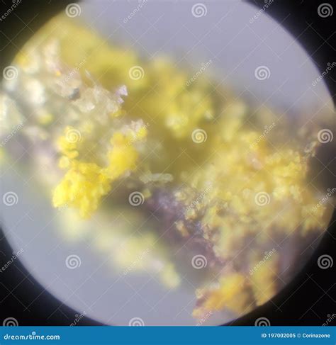 Image result for Flower Pollen Under Microscope