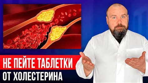 НИКОГДА не снижайте холестерин лекарствами! Как очистить сосуды от ...